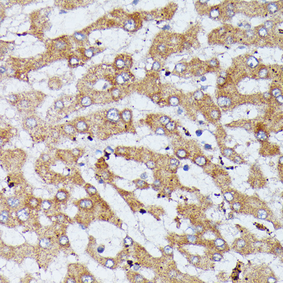 Anti-HDLBP Antibody (CAB6028)