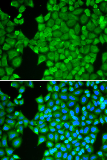 Anti-CA3 Antibody (CAB13473)