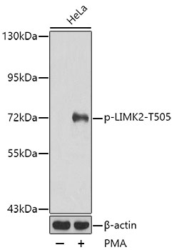 Anti-Phospho-LIM domain kinase 2-T505 Antibody (CABP0388)