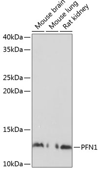 Anti-PFN1 Antibody (CAB1164)