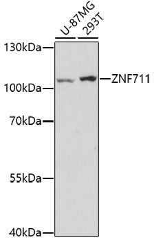 Anti-ZNF711 Antibody (CAB17008)