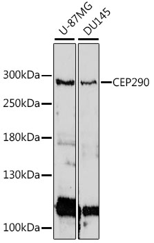 Anti-CEP290 Antibody (CAB16147)