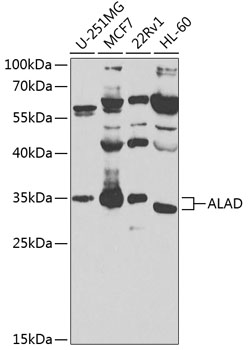 Anti-ALAD Polyclonal Antibody (CAB8398)