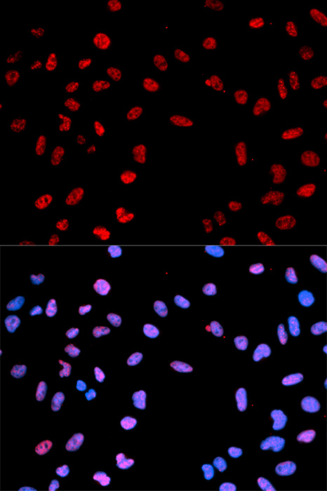 Anti-Phospho-AKT1-T450 Antibody (CABP0004)