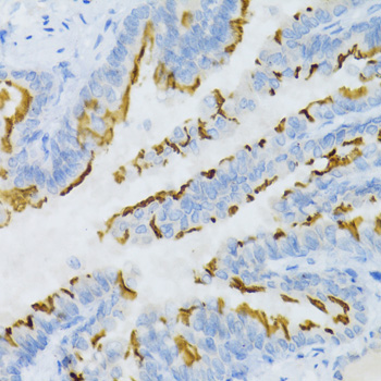 Anti-PTGER2 Antibody (CAB2914)