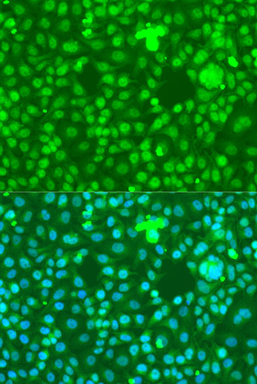 Anti-NOTCH1 Antibody [KO Validated] (CAB7636)