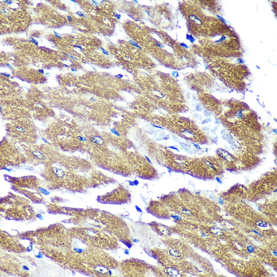 Anti-NDUFAF4 Antibody (CAB14345)