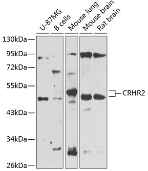 Anti-CRHR2 Antibody (CAB12428)