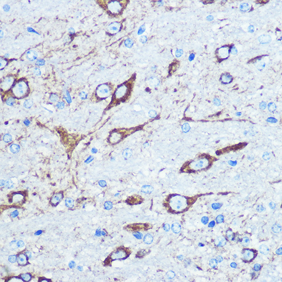 Anti-GRIN1 Antibody (CAB7677)