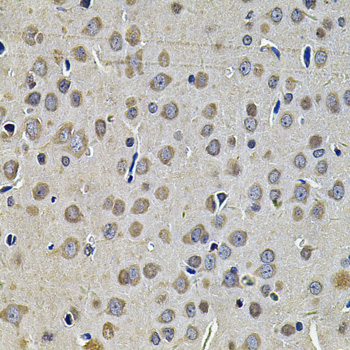 Anti-DNAJA3 Antibody (CAB7030)