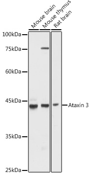 Anti-Ataxin 3 Antibody (CAB1243)