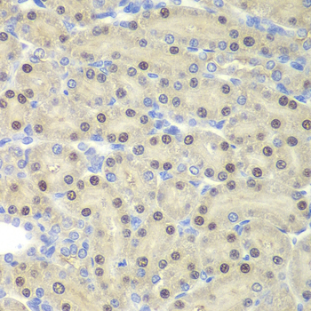 Anti-ELF3 Antibody (CAB6371)