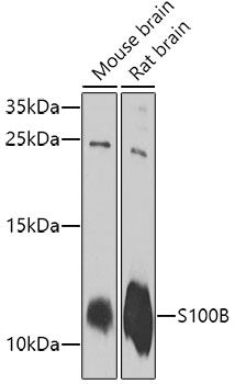 Anti-S100B Antibody (CAB0676)