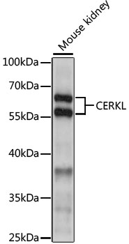 Anti-CERKL Antibody (CAB15984)