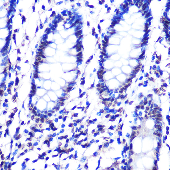 Anti-Phospho-ERK1-T202/Y204 + ERK2-T185/Y187 Antibody (CABP0472)