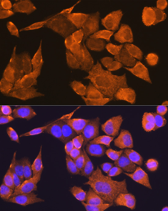 Anti-PFDN5 Antibody (CAB4014)