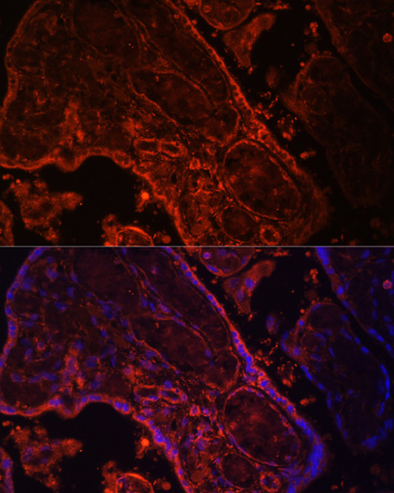 Anti-WNT3A Antibody (CAB0642)