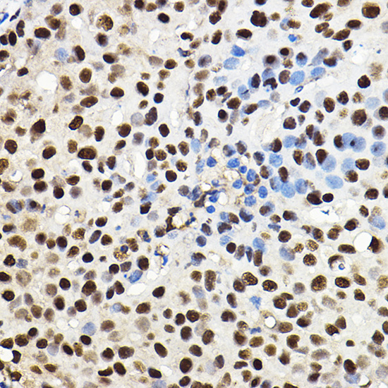 Anti-HIF1Alpha Antibody [KO Validated] (CAB16873)