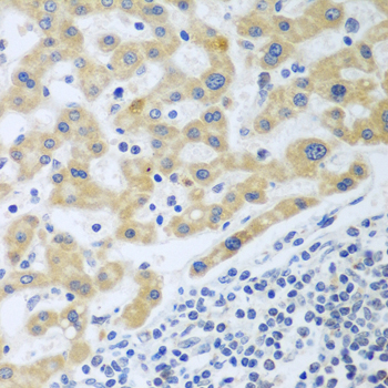 Anti-SHBG Antibody (CAB7450)