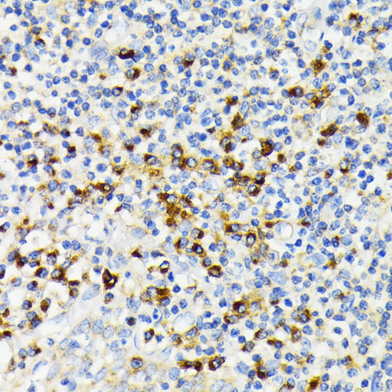 Anti-USO1 Antibody (CAB2796)