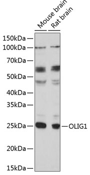 Anti-OLIG1 Antibody (CAB17251)