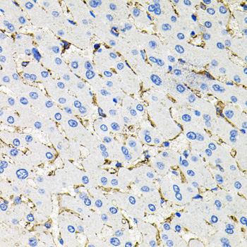 Anti-SSTR2 Antibody (CAB3135)