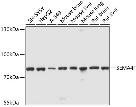 Anti-SEMA4F Antibody (CAB10432)