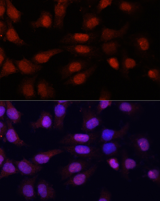 Anti-N5-Methylcytidine Antibody (CAB2341)