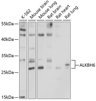 Anti-ALKBH6 Antibody (CAB10004)