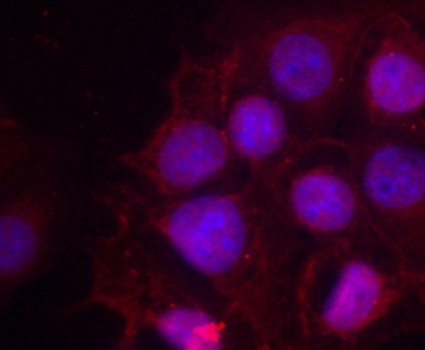 Anti-Phospho-Estrogen receptor-S118 Antibody (CABP0146)