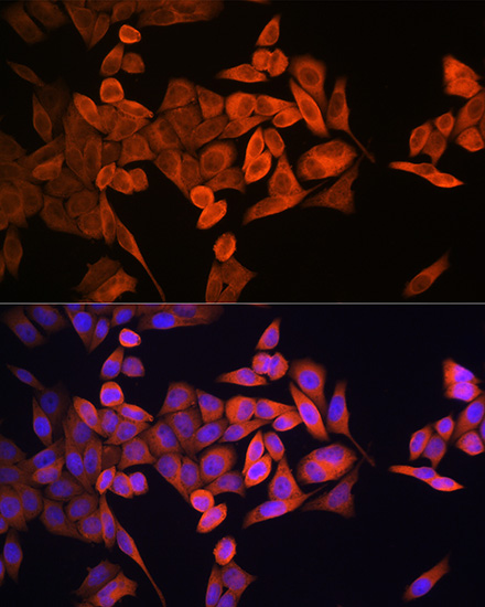 Anti-RRM1 Antibody (CAB13656)