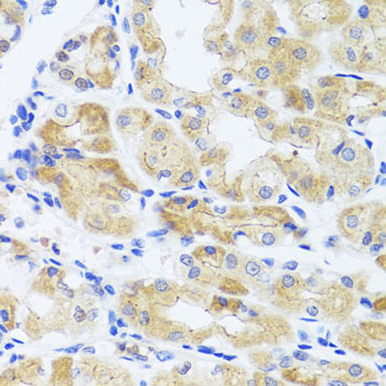 Anti-InaD-like protein Polyclonal Antibody (CAB8476)