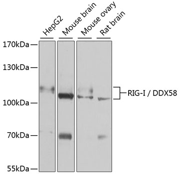Anti-RIG-I / DDX58 Antibody (CAB13407)