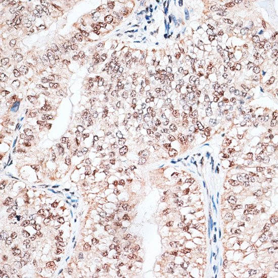 Anti-RBM3 Antibody (CAB5931)