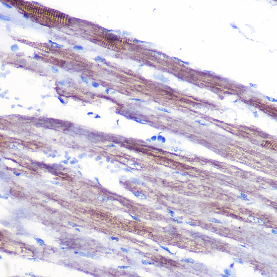 Anti-MYH1 Antibody (CAB6935)