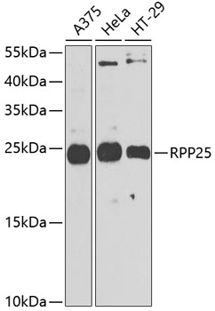 Anti-RPP25 Polyclonal Antibody (CAB9973)