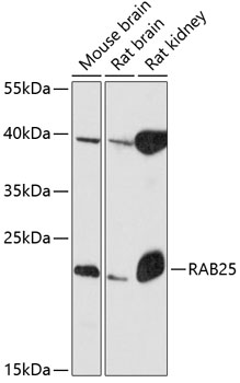 Anti-RAB25 Antibody (CAB12275)