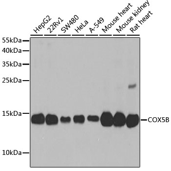 Anti-COX5B Antibody (CAB2640)