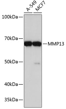 Anti-MMP13 Antibody