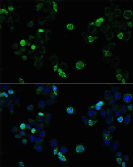 Anti-MRP4 / ABCC4 Antibody (CAB2198)