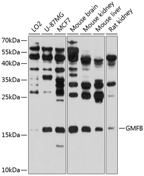 Anti-GMFB Polyclonal Antibody (CAB8652)