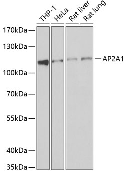 Anti-AP2A1 Antibody (CAB6863)