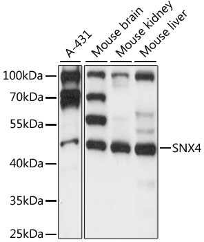 Anti-SNX4 Antibody (CAB15342)