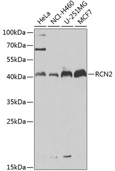 Anti-RCN2 Antibody (CAB7721)