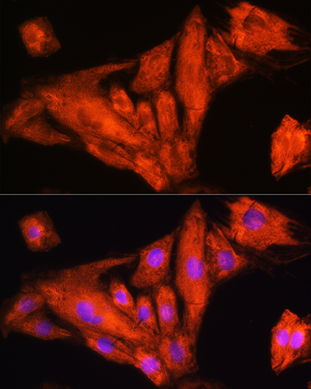 Anti-RIG-I / DDX58 Antibody (CAB13407)