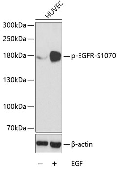 Anti-Phospho-EGFR-S1070 Antibody (CABP0153)