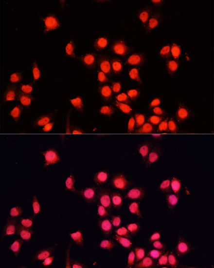 Anti-BACH1 Antibody (CAB5393)