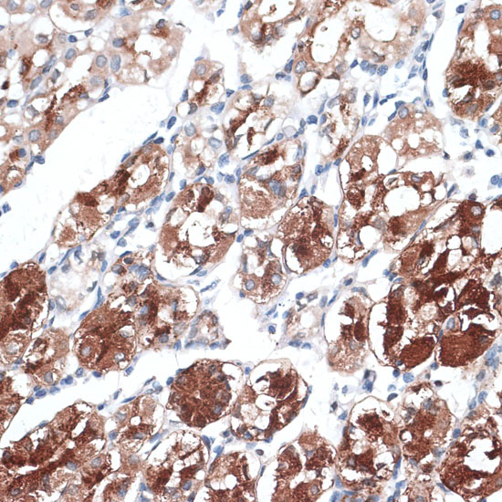 Anti-DTNBP1 Antibody (CAB16581)