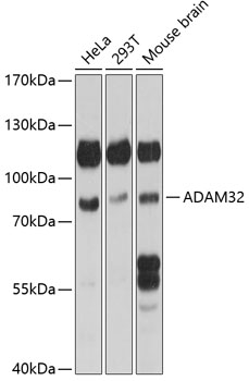 Anti-ADAM32 Antibody (CAB14977)