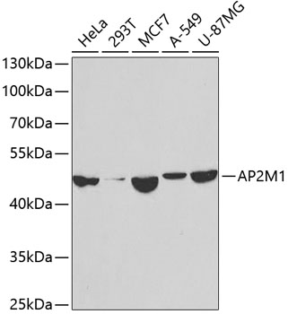 Anti-AP2M1 Antibody (CAB2492)